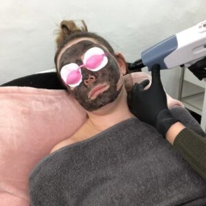 laser carbon facial by beauty spa salon canterbury